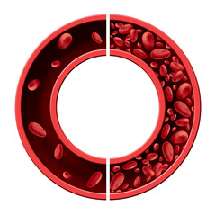 Anemia Anaemia Concept Diagram