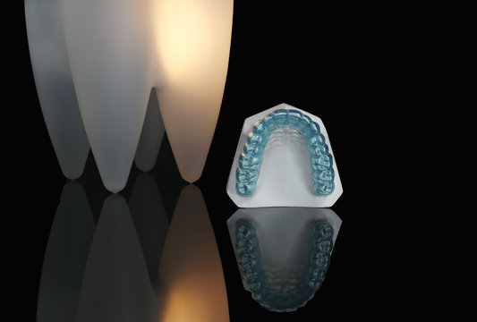 Night guard blue on teeth model