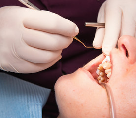 Fototapeta na wymiar Dentist making patient's teeth hygiene