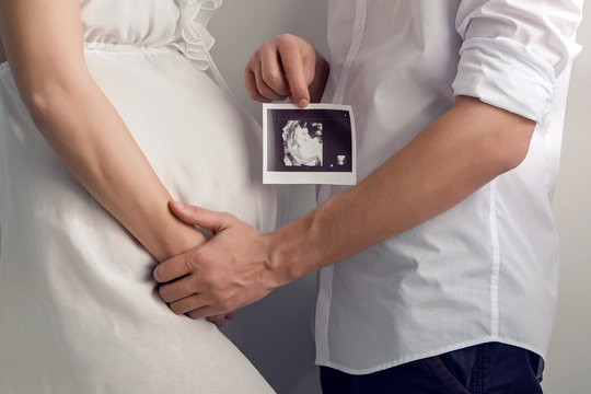 pregnant girl holding with their hands the belly and the husband keeps the hand in the ultrasound of their baby