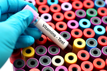 Fototapeta premium Vitamins test