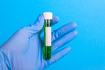 test tube with the virus in the hand with a glove