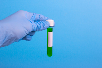 test tube with the virus in the hand with a glove