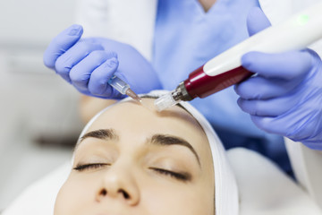 Mesotherapy with an Intradermal Hyaluronic Acid Formulation for Skin Rejuvenation