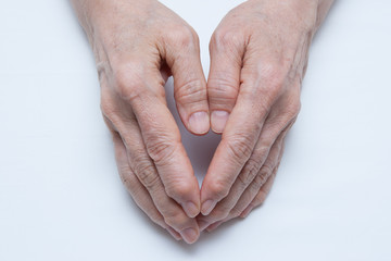 Fototapeta premium Osteoarthritis Hands and fingers of a female's hands.