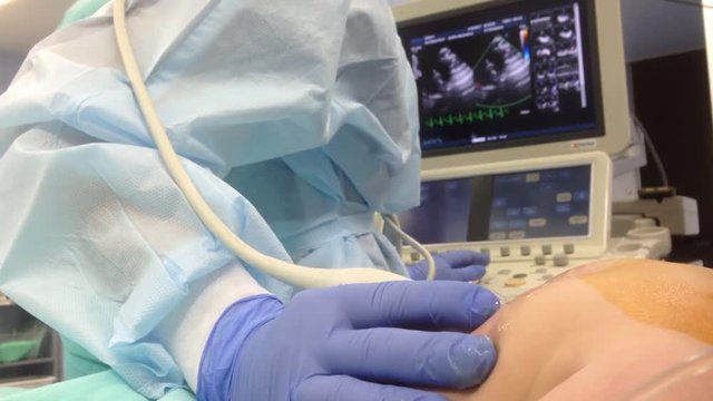 ultrasound of the heart in the operating room