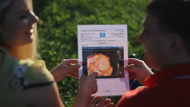 photo with ultrasound of baby in the womb in parents hands