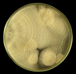 Furry colonies of fungus on a petri dish (agar plate) isolated on a black background by pen tool....