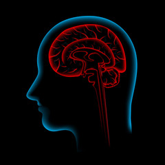 Pain in the Brain, x ray