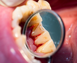 dental treatment in dentistry