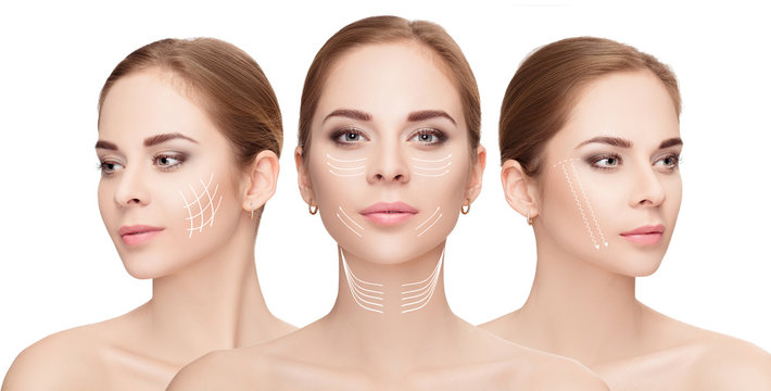  woman faces with arrows over white background. Face lifting con