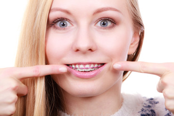 Happy woman showing her braces on teeth