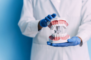 Dental model of jaw.