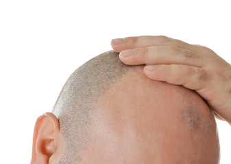 Bald adult man on white background, closeup