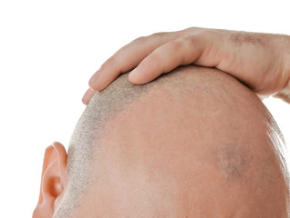 Bald adult man on white background, closeup