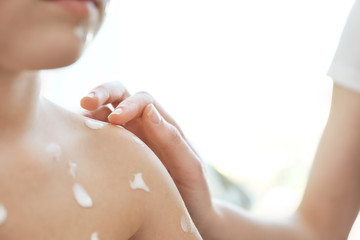 Obraz na płótnie Canvas Female hand applying cream onto skin of child ill with chickenpox, closeup