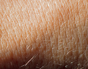 hairs on the skin