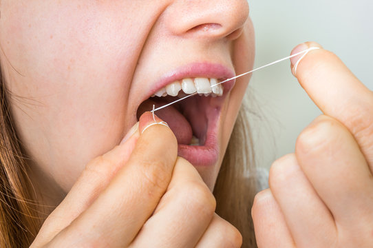 Woman Flossing Teeth With Dental Floss