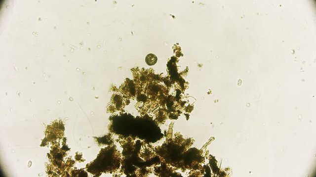 Mikroorganismus unter dem Mikroskop in 4K