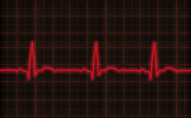 Кардиограмма на черном фоне.