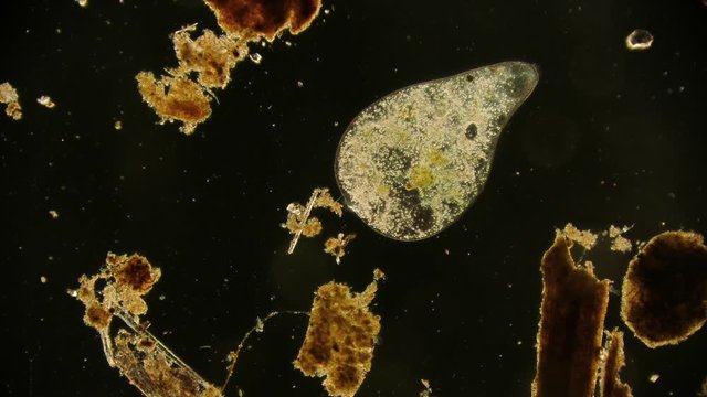 Mikroorganismus unter dem Mikroskop in 4K