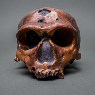 skull without a jaw
