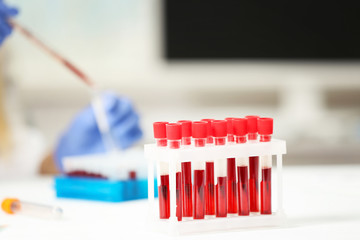 Test tubes with blood in laboratory on blurred background