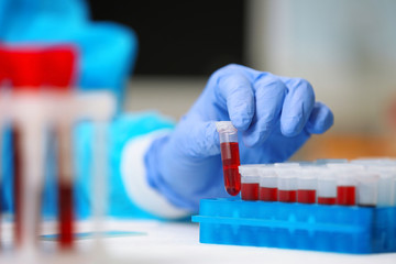 Scientist working with blood sample in laboratory