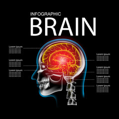 Pain in the Brain, x ray