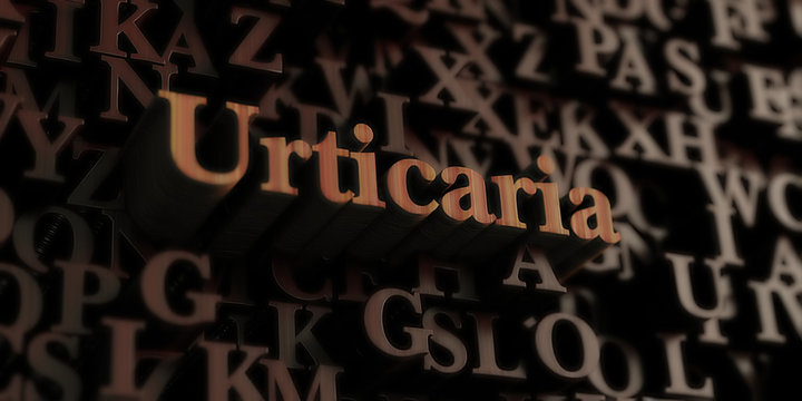 Urticaria - Wooden 3D rendered letters/message.  Can be used for an online banner ad or a print postcard.