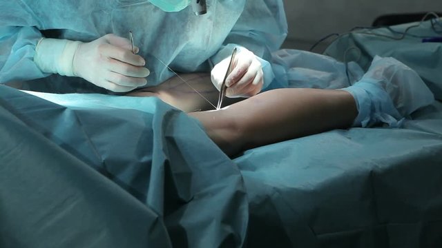 Surgeon Stitching up during operation in operating room.