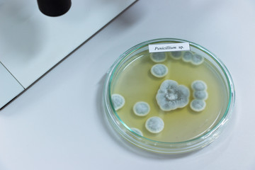 Fototapeta na wymiar Fungus in Petri dishes on table gray in Lab.