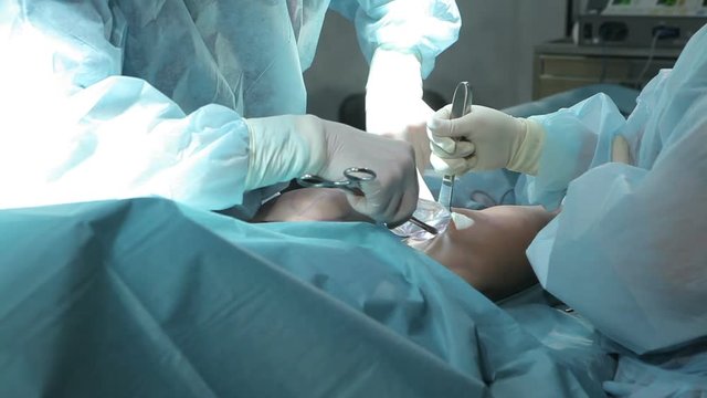 Surgeon inserting implant during operation in operating room