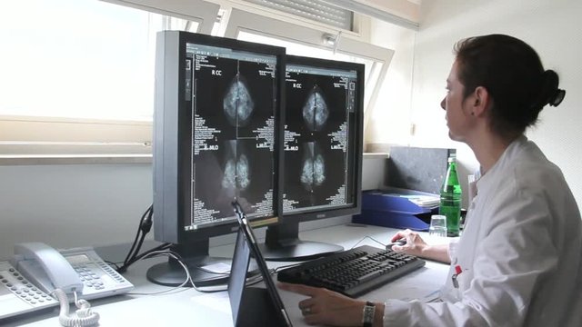 Young Woman Doctor Examines the Results of Patient Famale Breast Cancer Research on the Computer