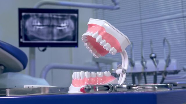 Tooth model against the backdrop of a panoramic X-ray at the dentist's office