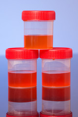 Three urine sample tube