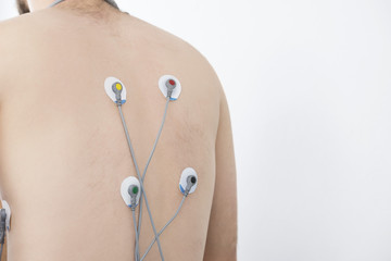 Patient With Electrostimulator Electrodes Attached On Back