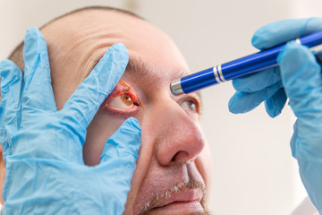 Nahaufnahme, Augenärztin leuchtet in Auge von Patient, Reaktionstest