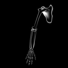 Arm bone and finger bone,pain,x ray