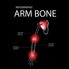 Arm bone and finger bone,pain,x ray