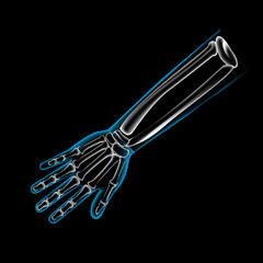 Arm bone and finger bone,pain,x ray