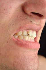 Detailed image of man showing his teeth. Dental health care. Hygiene. Dentistry