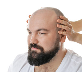 Fototapeta premium Female hands touching head of bald adult man on white background