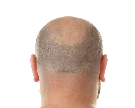 Bald adult man on white background