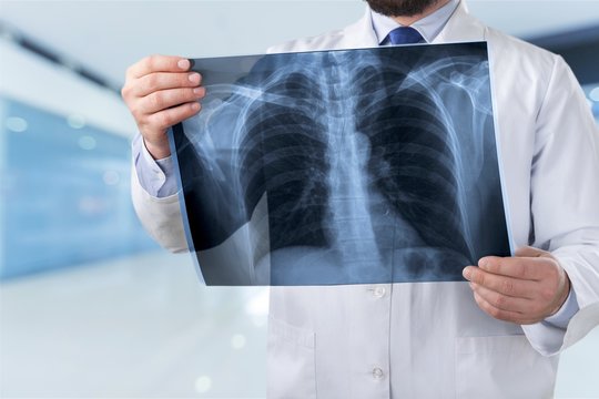 Doctor Looking Chest X-ray Film.