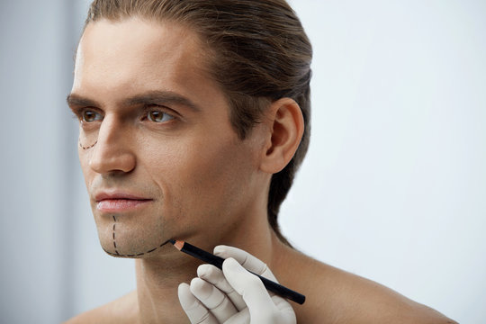 Handsome Man With Black Lines On Face Before Plastic Surgery