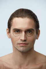 Fototapeta premium Plastic Surgery. Portrait Handsome Man With Lines On Face Skin
