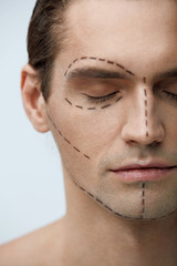 Plastic Surgery. Portrait Of Handsome Man With Lines On Face
