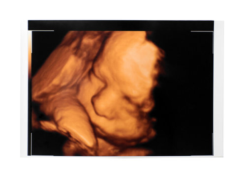 Ultrasound of baby on white background