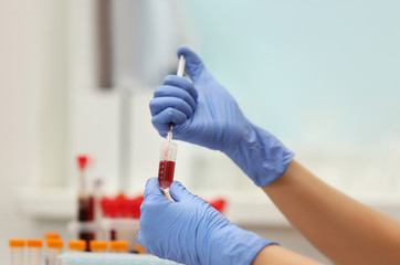 Scientist working with blood sample in laboratory